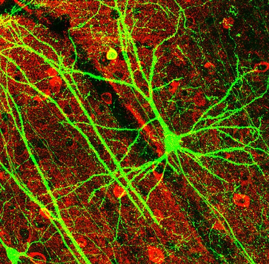 komplexe dynamische Verbindungen Neuronenverbindung